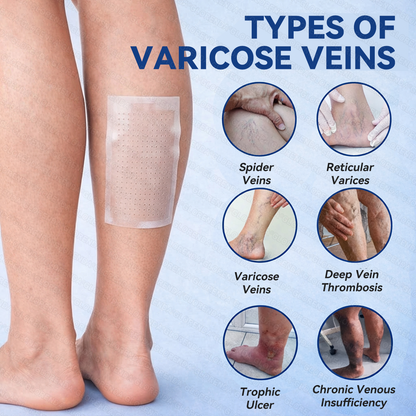 𝐆𝑳𝑶𝗥𝙀𝙉𝐃𝑨® 𝐕𝐞𝐢𝐧 𝐂𝐨𝐧𝐭𝐨𝐮𝐫 𝐌𝐢𝐜𝐫𝐨𝐧𝐞𝐞𝐝𝐥𝐞 𝐏𝐚𝐭𝐜𝐡 (𝐉𝐮𝐬𝐭 𝐎𝐧𝐜𝐞 𝐃𝐚𝐢𝐥𝐲, 𝐕𝐢𝐬𝐢𝐛𝐥𝐞 𝐑𝐞𝐬𝐮𝐥𝐭𝐬 𝐢𝐧 𝟕 𝐃𝐚𝐲𝐬) — 𝐒𝐮𝐢𝐭𝐚𝐛𝐥𝐞 𝐟𝐨𝐫 𝐕𝐚𝐫𝐢𝐜𝐨𝐬𝐞 𝐕𝐞𝐢𝐧𝐬 𝐚𝐧𝐝 𝐒𝐩𝐢𝐝𝐞𝐫 𝐕𝐞𝐢𝐧𝐬, 𝐇𝐞𝐥𝐩𝐬 𝐑𝐞𝐥𝐢𝐞𝐯𝐞 𝐋𝐞𝐠 𝐇𝐞𝐚𝐯𝐢𝐧𝐞𝐬𝐬, 𝐅𝐚𝐭𝐢𝐠𝐮𝐞, 𝐚𝐧𝐝 𝐉𝐨𝐢𝐧𝐭 𝐏𝐚𝐢𝐧